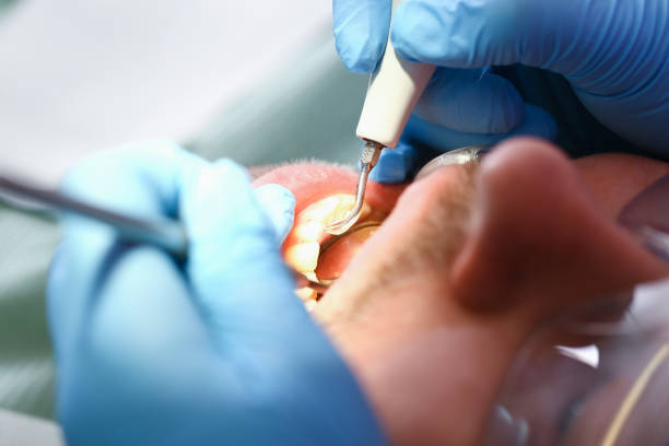 Best Cosmetic Emergency Dentistry in Carlisle Rockledge, AL